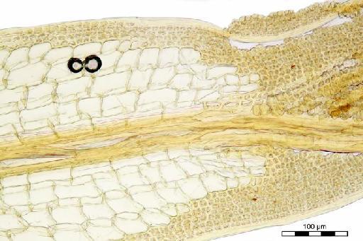 Syrrhopodon gaudichaudii Mont. - Syrrhopodon erectifolius_BM000677468hyaline.