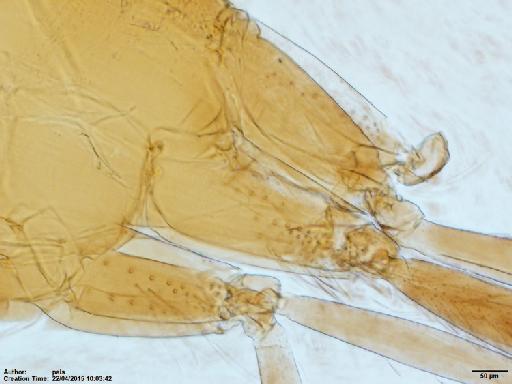 Lutzomyia (Nyssomyia) richardwardi Ready & Fraiha, 1981 - Lutzomyia_richardwardi_BMNH(E)1722064_PT-female_coxae-10x.tif
