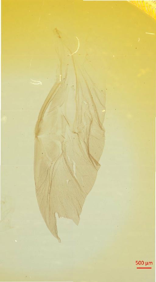 Melolonthinae Leach, 1819 - 010130255___14