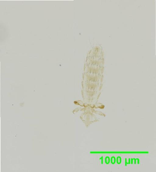 Polyplax oxyrrhynchus Cummings, 1915 - 010155567__2015_12_23_s2