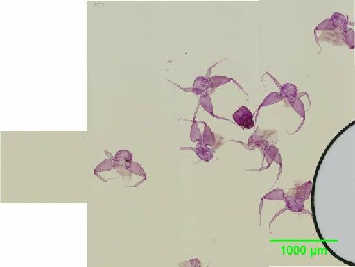 Liposcelis albothoracicus Broadhead, 1955 - 010150248__2016_03_15-4_s09