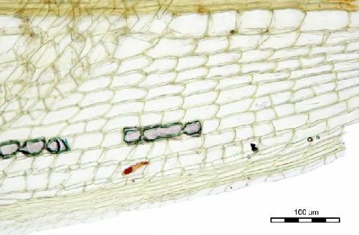 Calymperes erosum Müll.Hal. - Calymperes intralimbatum_BM000518376leafbase.