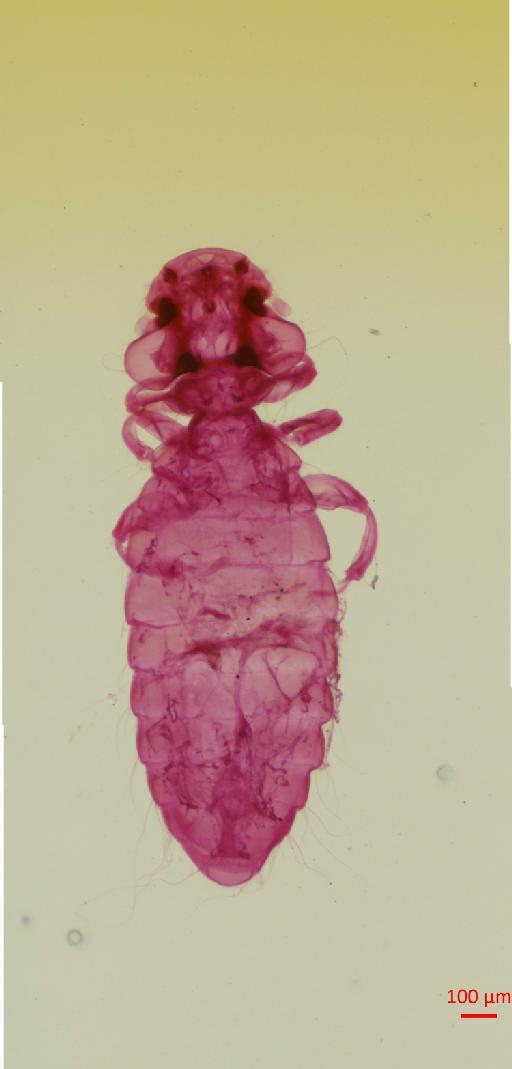 Neocolpocephalum lophaetivorum Eichler - 010655814__2017_07_20-Scene-2-ScanRegion1