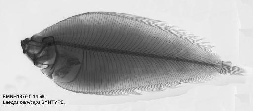 Laeops parviceps Günther, 1880 - BMNH 1879.5.14.98, SYNTYPE, Laeops parviceps X-ray