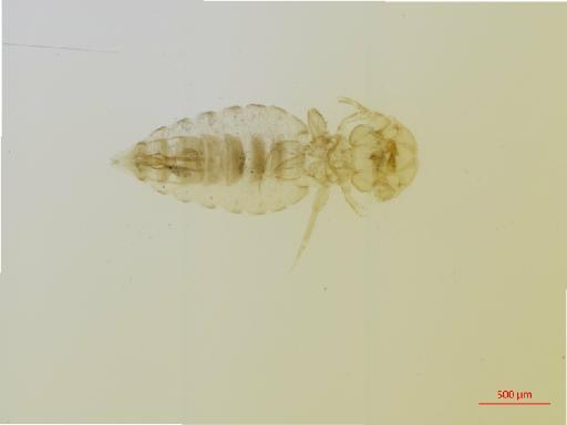 Damalinia harrisoni Cummings, 1916 - 010695947__2017_08_16-Scene-1-ScanRegion0