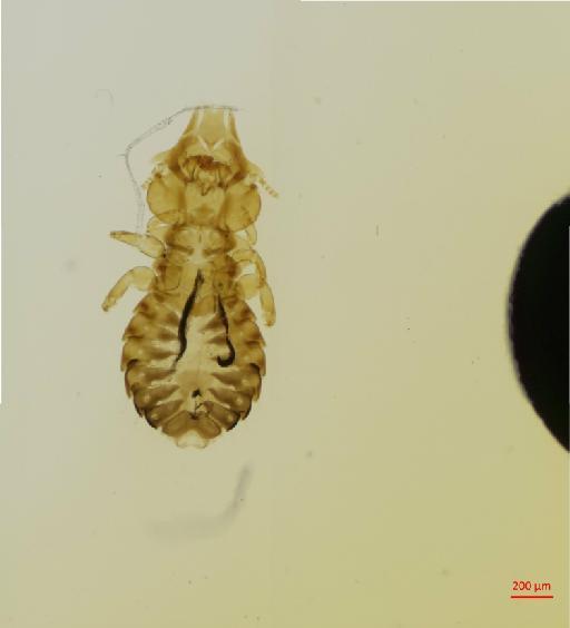 Saemundssonia celidoxa Burmeister, 1838 - 010690979__2017_08_11-Scene-1-ScanRegion0