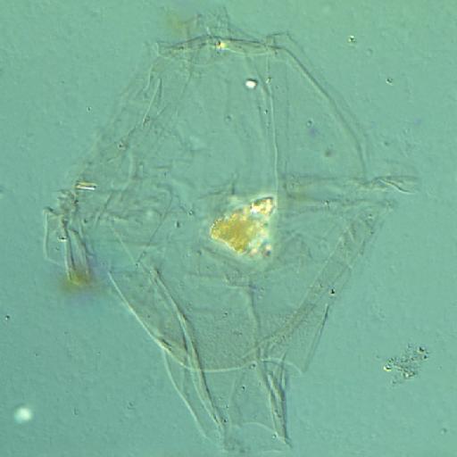 Leptodinium egemenii Gitmez, 1970 - FD150(3)-2.tif