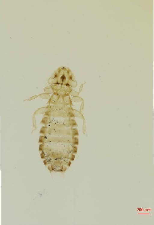 Pseudomenopon scopulacorne Denny, 1842 - 010663579__2017_07_26-Scene-1-ScanRegion0