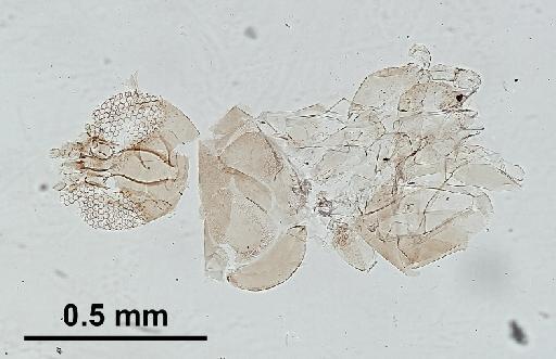Trichomyia cirrata Coquillett, 1902 - Trichomyia_cirrata-010210264-head_thorax-100_0x-scale