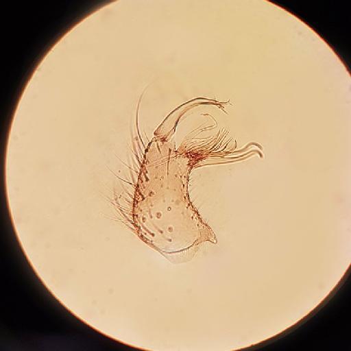 Culex acutipalus Colless - 012816245_Culex_acutipalus_gonocoxite_male_x22