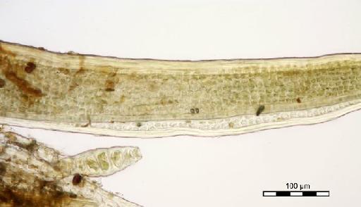 Syrrhopodon platycerii Mitt. - Syrrhopodon novae-valesiae_BM000672651gemmaeandmargin.jp