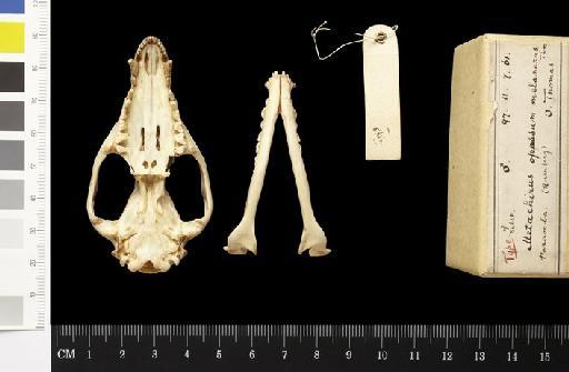 Metachirus opposum melanurus Thomas, 1899 - 1897.11.7.61_Skull_Ventral