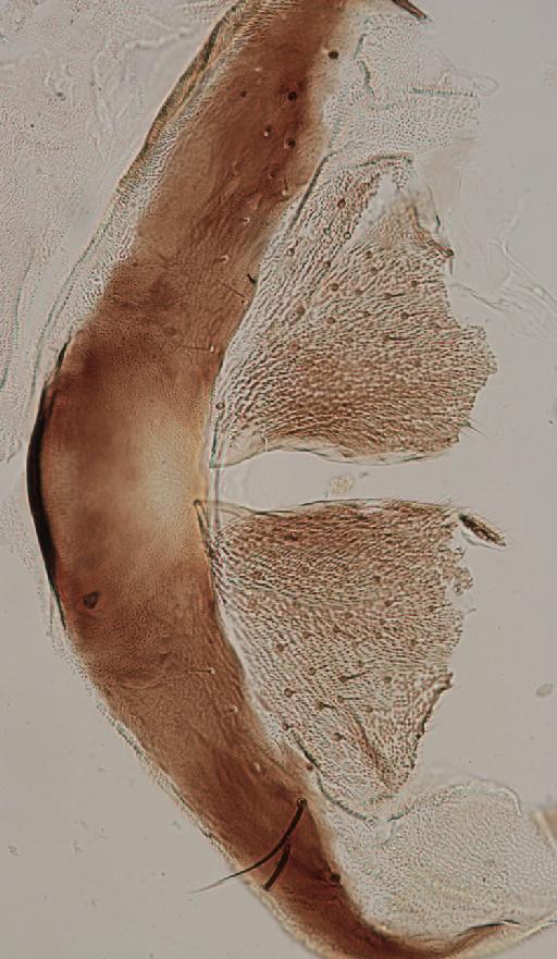 Simulium (Trichodagmia) tarsale species group Tarsatum Williston, 1896 - 010195843_S_tarsale_Lectotype_female_hypoginial valves