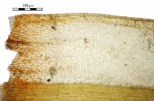 Tridontium tasmanicum Hook.f. - Cinclidotus australis_BM001006465leafbase.jpg