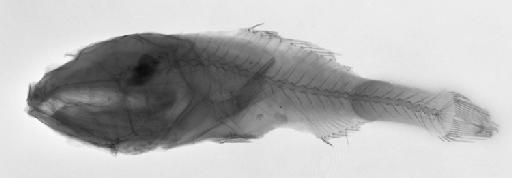 Scopelus crassiceps Günther, 1878 - Scopelus crassiceps SYNTYPE 1887.12.7.6, radiograph