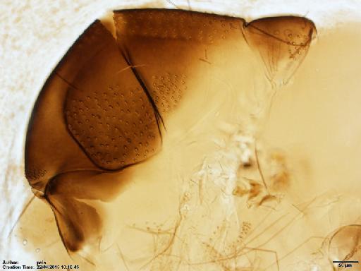 Lutzomyia (Nyssomyia) shawi Fraiha et al., 1981 - Lutzomyia_shawi_BMNH(E)1722062_PT-female_upper_thorax-10x.tif