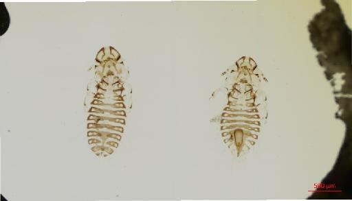 Corvonirmus quadrangularis Rudow, 1869 - 010670852__2017_07_31-Scene-1-ScanRegion0