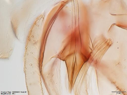 Lutzomyia aulari species group Verrucarum Feliciangeli et al., 1984 - Lutzomyia_aulari-BMNH(E)1722088_HT-male_sperm_ducts_tips-40x.tif