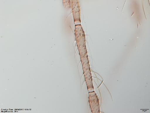 Lutzomyia (Psathyromyia) dasymera Fairchild & Hertig, 1961 - Lutzomyia_dasymera-BMNH(E)1251322_PT-male_ascoids_F2-20x.tif