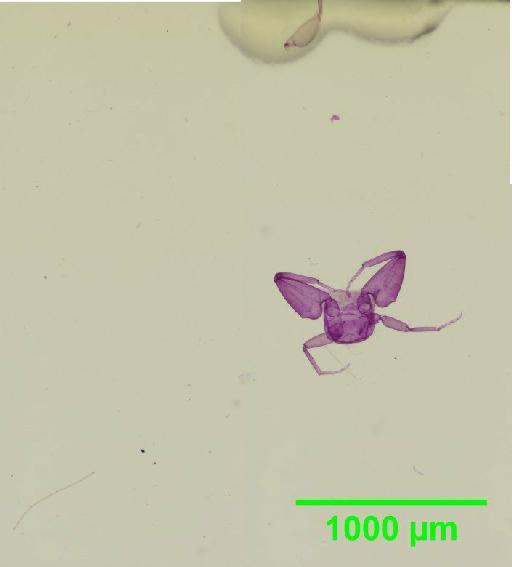 Liposcelis albothoracicus Broadhead, 1955 - 010150241__2016_03_15-4_s12