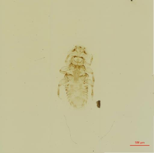 Myrsidea robsoni Cummings, 1914 - 010661065__2017_07_26-Scene-1-ScanRegion0