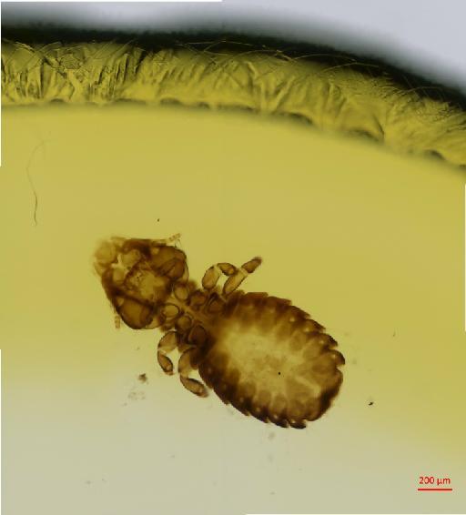 Anatoecus icterodes emersoni Keler, 1960 - 010666913__2017_07_28-Scene-1-ScanRegion0