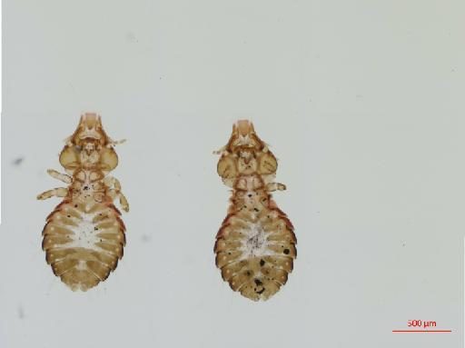 Saemundssonia halobaenus Timmermann, 1965 - 010691243__2017_08_11-Scene-1-ScanRegion0