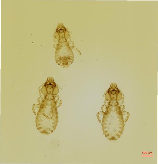 Strigiphilus riparius Clay, 1974 - 010693612__2017_08_11-Scene-1-ScanRegion0