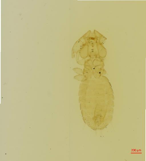 Eutrichophilus lobatus Ewing, 1936 - 010696584__2017_08_16-Scene-1-ScanRegion0