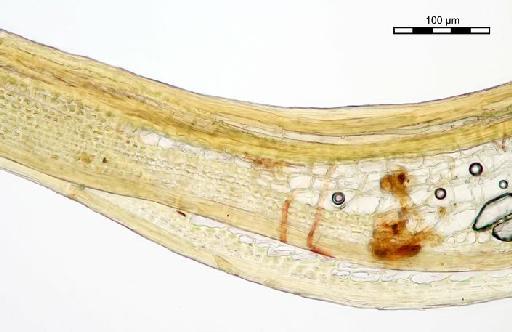 Syrrhopodon leprieurii Mont. - Syrrhopodon pallidus_BM000664049hyaline2.