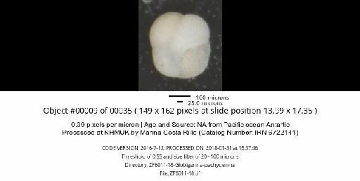 Neogloboquadrina pachyderma (Ehrenberg) - ZF6011-18-Globigerina-pachyderma_obj00009_plane000.jpg