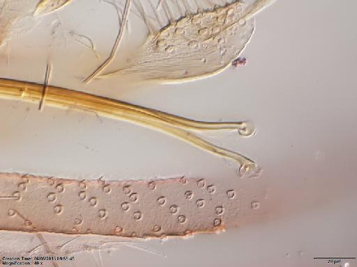 Lutzomyia walkeri species group Migonei Newstead, 1914 - Lutzomyia_walkeri-BMNH(E)1722099_LT-male_sperm_ducts_tip-40x.tif