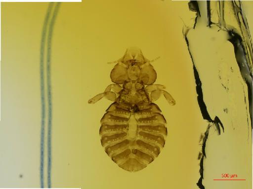 Saemundssonia platygaster frater Giebel, 1874 - 010692056__2017_08_11-Scene-1-ScanRegion0