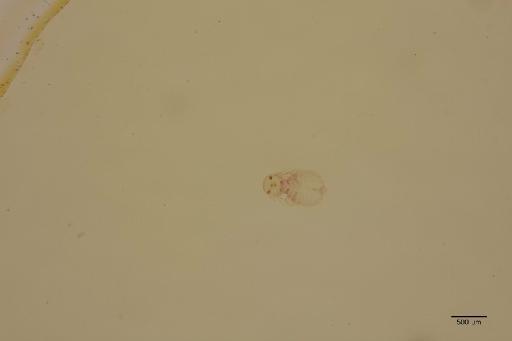 Goniocotes gallinae De Geer, 1778 - 010675615_specimen
