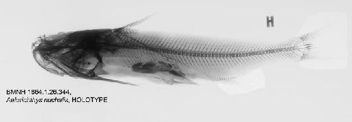 Aelurichthys nuchalis Günther, 1864 - BMNH 1864.1.26.344, HOLOTYPE, Aelurichthys nuchalis Radiograph