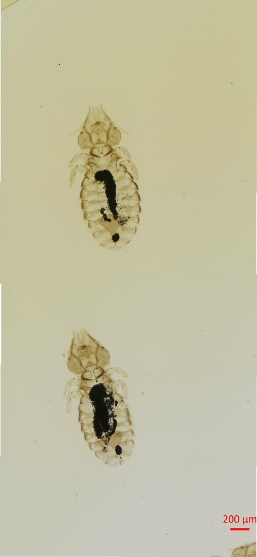 Sturnidoecus galbula Tendeiro, 1963 - 010694499__2017_08_11-Scene-1-ScanRegion0