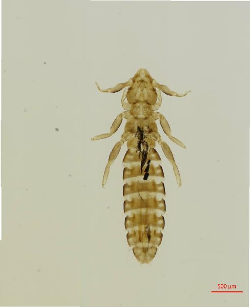 Pectinopygus socotranus Timmermann, 1964 - 010684106__2017_08_09-Scene-1-ScanRegion0