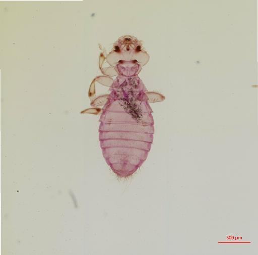 Franciscoloa rorati Price & Beer, 1966 - 010656783__2017_07_21-Scene-1-ScanRegion0