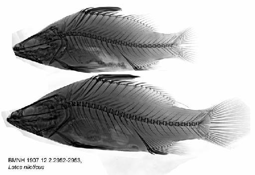 Lates niloticus (Linnaeus, 1758) - BMNH 1907.12.2.2952-2953, Lates niloticus, Radiograph
