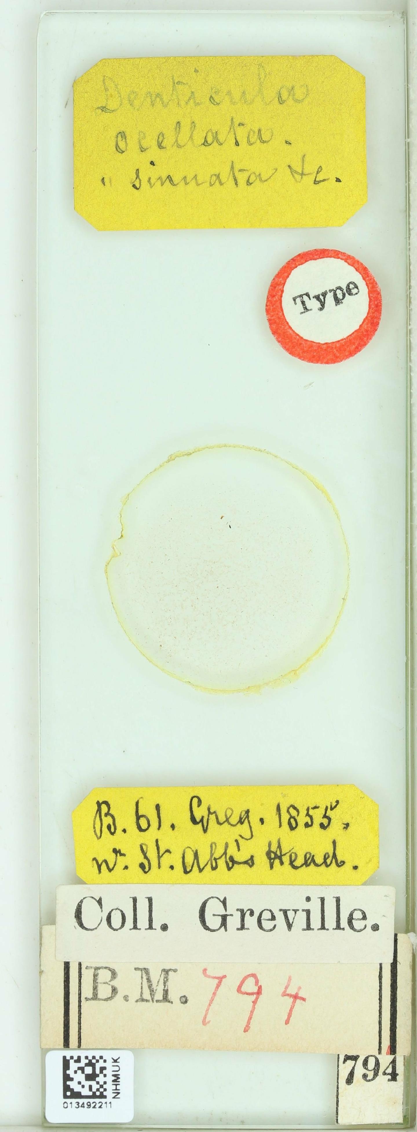 To NHMUK collection (Denticula ocellata W.Sm.; Type; NHMUK:ecatalogue:4730812)