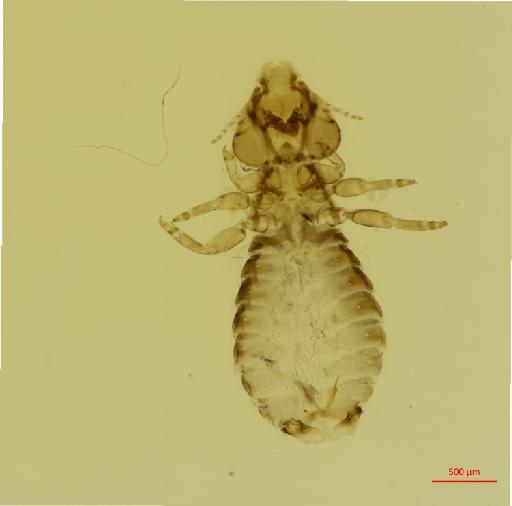 Neophilopterus sarae Tendeiro, 1958 - 010678693__2017_08_08-Scene-1-ScanRegion0