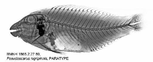 Pseudoscarus nigripinnis Günther in Playfair & Günther, 1867 - BMNH 1865.2.27.80, Pseudoscarus nigripinnis, PARATYPE, Radiograph