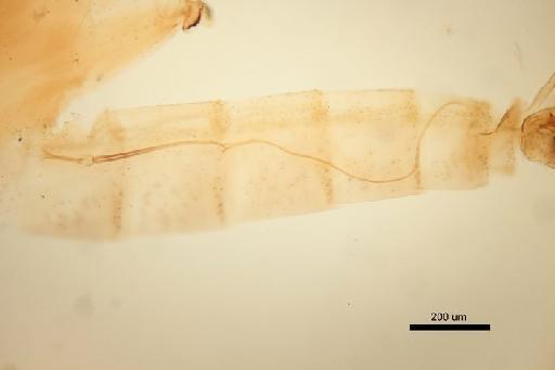 Phlebotomus (Adlerius) angustus Artemiev - Phlebotomus_angustus-010210145-Abdomen-malegenitalpump,filament-10x_1_6