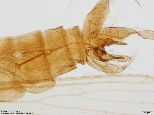 Lutzomyia (Nyssomyia) shawi Fraiha et al., 1981 - Lutzomyia_shawi_BMNH(E)1251316_PT-male_terminalia-10x.tif