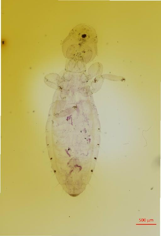 Ornithobius waterstoni Timmermann, 1962 - 010679663__2017_08_08-Scene-1-ScanRegion0