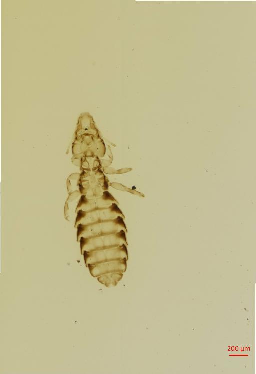 Quadraceps eggleringi Timmermann, 1954 - 010687032__2017_08_10-Scene-1-ScanRegion0