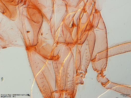 Lutzomyia spinicrassa species group Verrucarum Morales-Alarcon et al., 1969 - Lutzomyia_spinacrassa-BMNH(E)1722094_PT-female_coxae-10x.tif