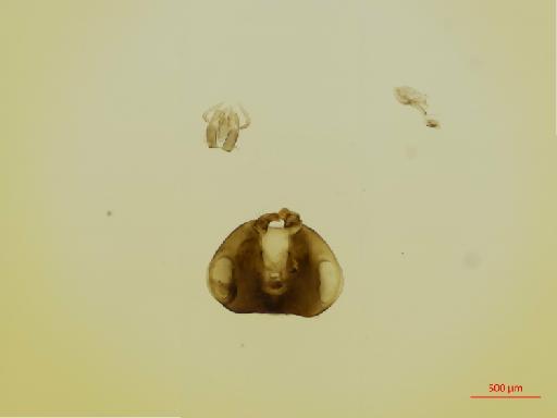 Hexacladia mantua Noyes, 2010 - 010178952__2017_01_31-Scene-4-ScanRegion3