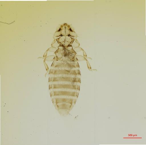 Heteromenopon laticapitis Carriker, 1963 - 010657132__2017_07_21-Scene-1-ScanRegion0