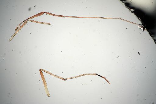 Paratendipes seydeli Freeman, 1957 - 010210312-Paratendipes_seydeli_HOLOTYPE-legs2_B-40_0x